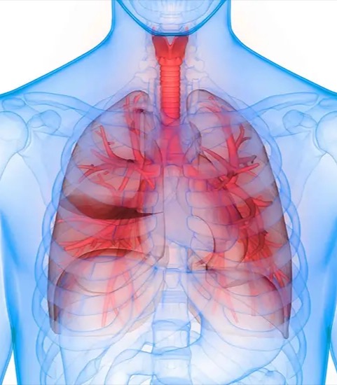 Due to a genetic defect, their lungs are affected. Patients are treated at a new centre in Brno