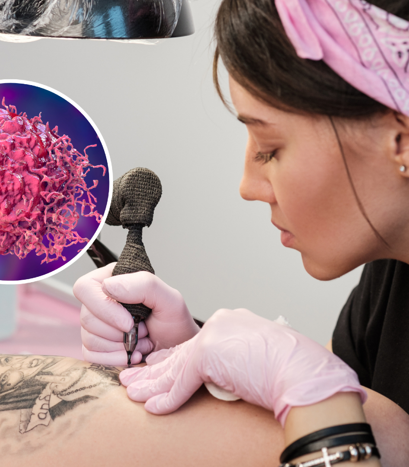 Tetování může být rizikovým faktorem pro vznik maligního lymfomu
