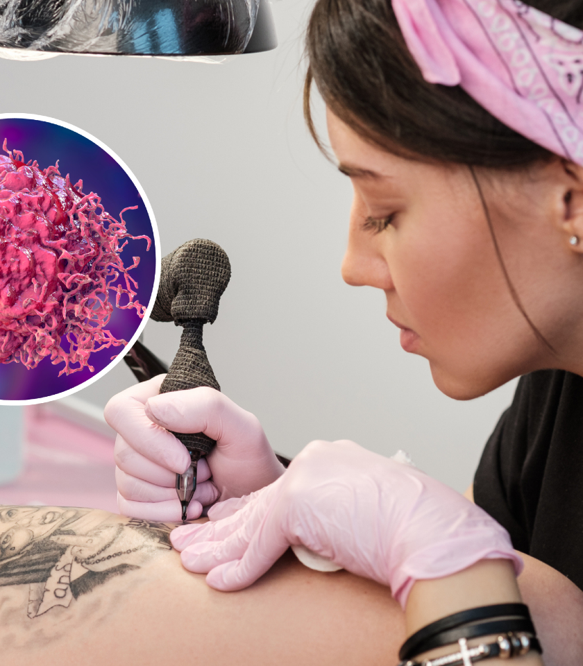 Tattoos may be a risk factor for malignant lymphoma