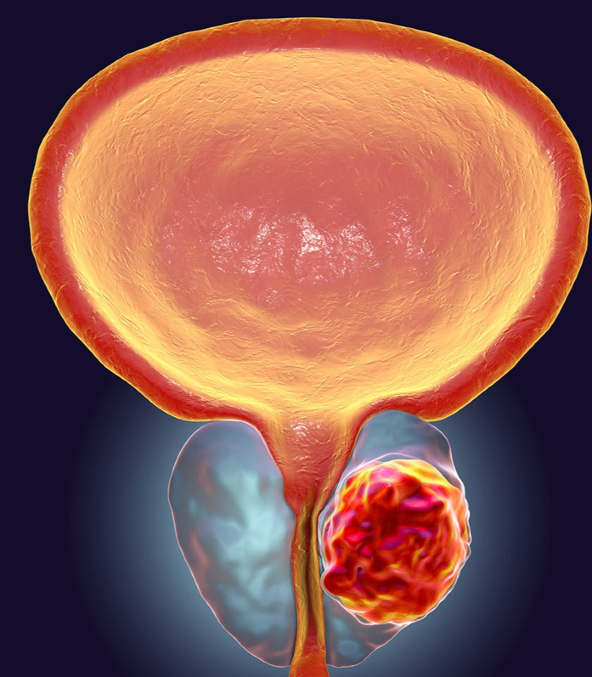 Article by Dr. Tereza Piskáčková on genetic predisposition to prostate cancer