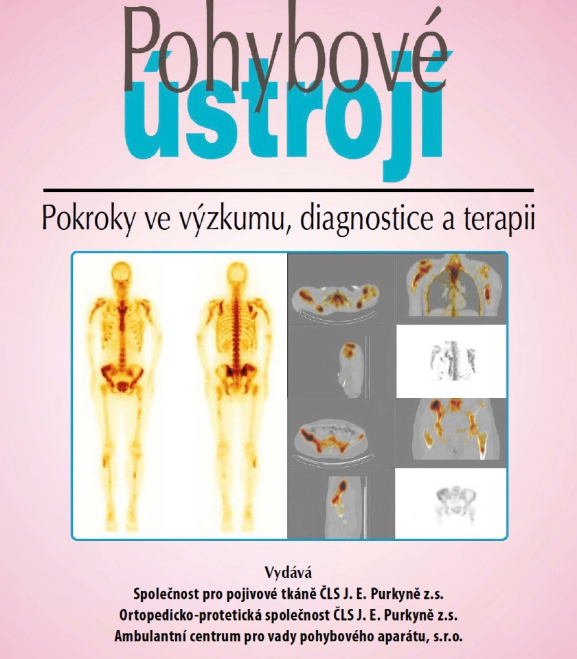 Publikovali jsme další odborné články v periodiku Pohybové ústrojí